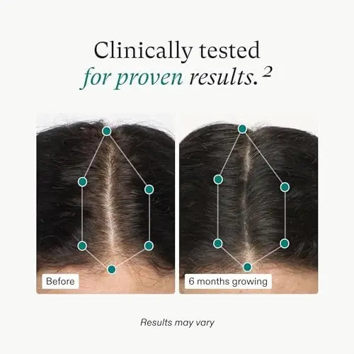 Nutrafol Women's Hair Growth Supplements – Clinically Proven, Dermatologist-Recommended for Thicker, Stronger Hair (1 Month Supply)
