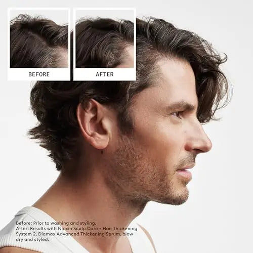 Nioxin System 2 Shampoo & Conditioner 33.8 fl oz – For Treated Hair with Thinning  Pumps Included